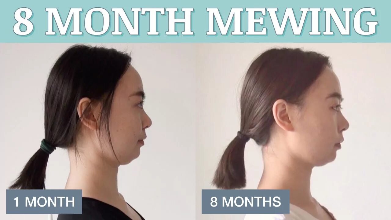 Мьюинг упражнения для исправления прикуса. Mewing. Mewing упражнения. Mewing before and after. Age 28