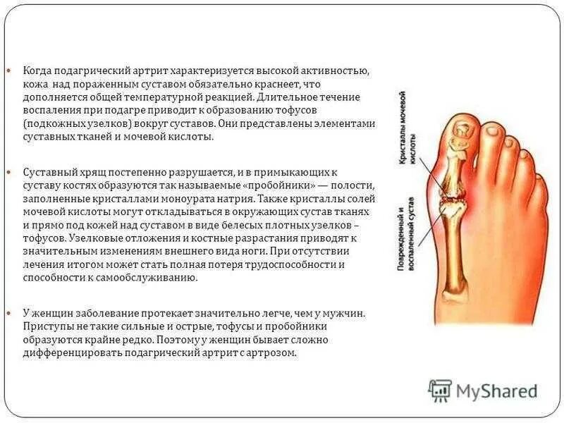 При воспалении суставов есть температура