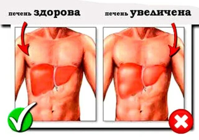 Причины заболевания печени человека - Здоровье - Медиаплатформа МирТесен
