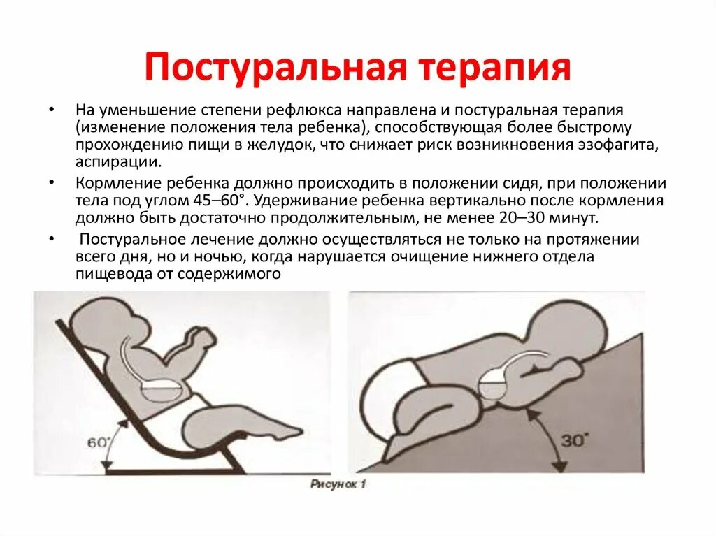 Постуральная терапия у детей. Постуральная дренаж у детей. Правильное положение ребенка при рвоте. Оптимальное положение ребенка при пневмонии. Постуральный массаж