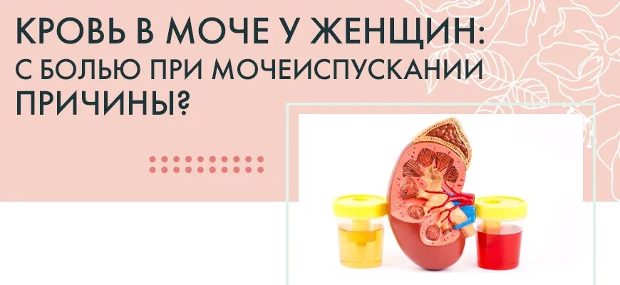 Почему писаешь кровью девушка. Резь при мочеиспускании лекарства. кровь в моче резь при мочеиспускании у женщины. лекарства при цистите с кровью у женщин.