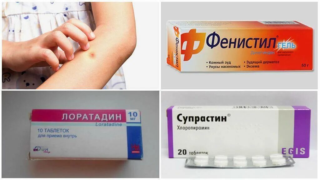 Как помочь ребенку при зуде