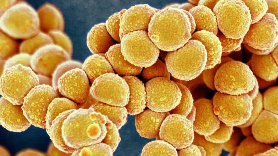 Staphylococcus aureus золотистый стафилококк. Стафилококк ауреус золотистый. Метициллин-резистентный золотистый стафилококк. Стафилококк золотистый Staphylococcus aureus. S. aureus золотистый стафилококк.