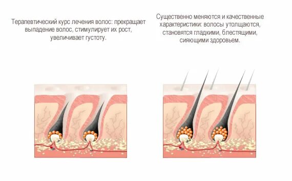 Как исправить рост волос. Для роста волос. стимулирование роста волос. что стимулирует рост волос. стимуляция роста волос на голове.