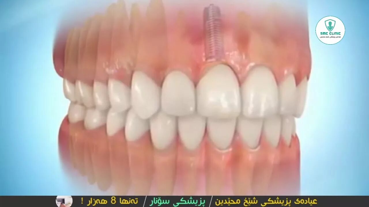 Зубы при закрытом рте. Правильный прикус челюсти. Привальный привкус зубов. Ортогнатический прикус резцы. Зубы верхней челюсти вид спереди.