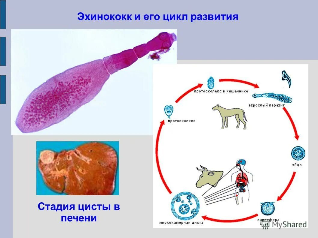 Стадии жизненного цикла цисты