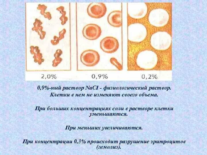 Эритроциты в различных растворах. Концентрация эритроцитов. Эритроциты в разных концентрациях. Физиологический раствор это гипотонический. Почему концентрация солей во внутренней