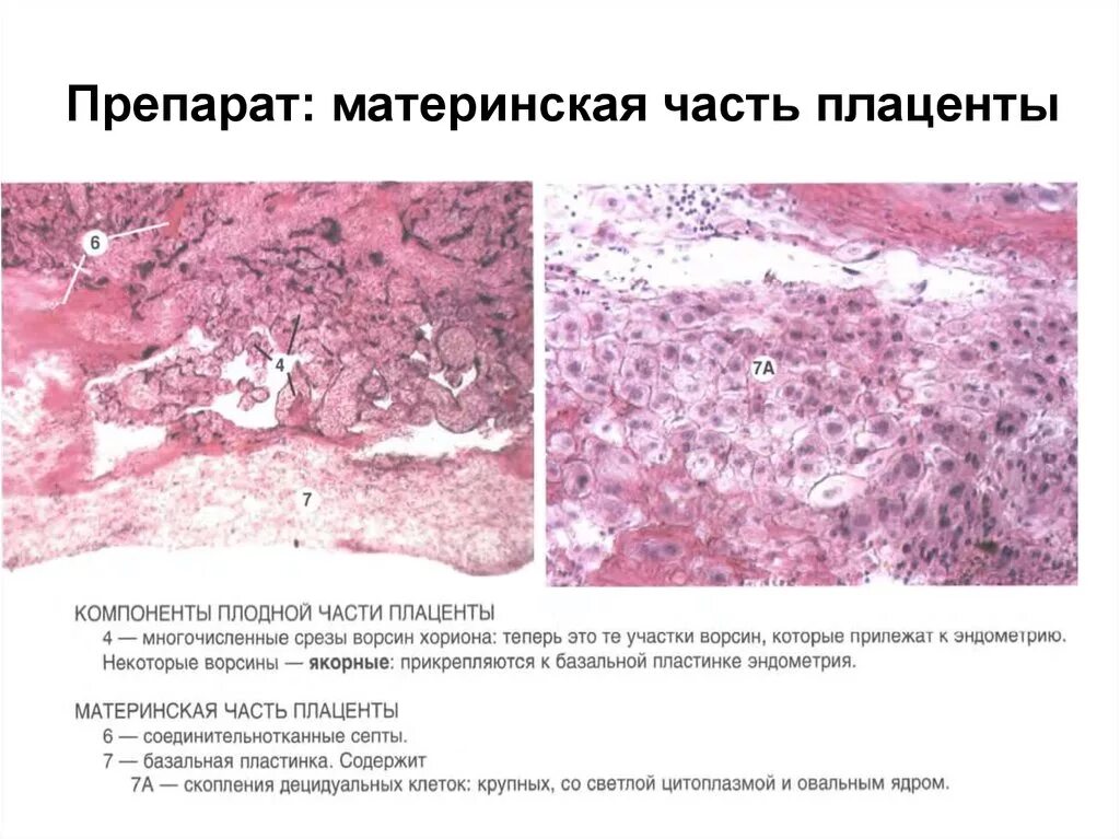 Материнская часть плаценты гистология препарат. Плацента плодная часть гистология препарат. Плацента материнская часть гистология препарат с подписями. Плацента человека материнская часть препарат гистология. Гистология при беременности