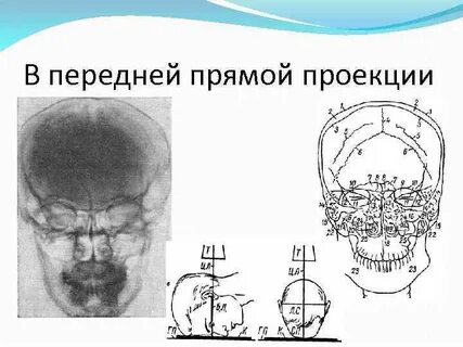 Череп проекции
