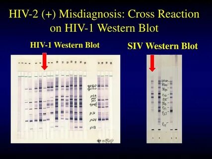Hiv 2