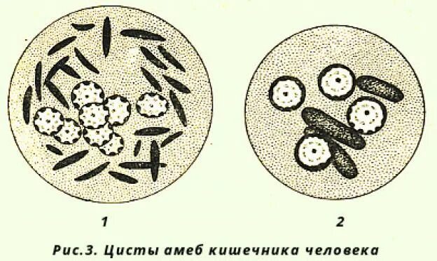 При наступлении неблагоприятных условий амеба. Циста дизентерийной амебы рисунок. Строение цист дизентерийной и кишечной амебы. Строение цисты кишечной амебы. Кишечная амеба строение.