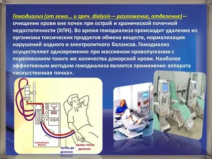 Механизм диализа