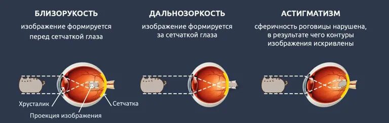 Правильная светопроекция в офтальмологии. Лазеры в офтальмологии книга. Вопросы лазерной офтальмологии. Изейкония это в офтальмологии.