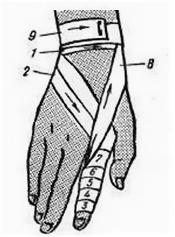Техника наложения повязки на кисть. Наложение повязки на один палец алгоритм. Колосовидная повязка на 1 палец. Спиральная повязка на палец алгоритм. Спиральная перевязка на палец.