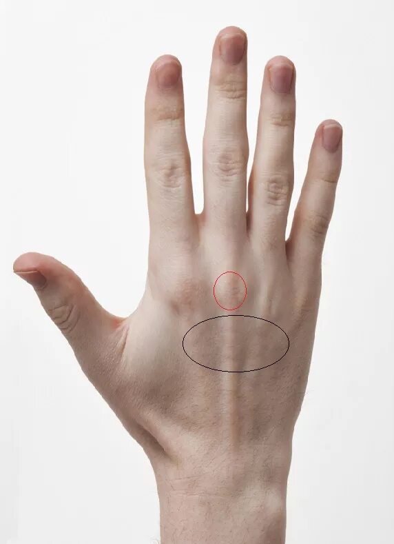 Как выглядит запястье руки. Карпальный туннельный синдром. Сухожилия лучезапястного сустава анатомия. Строение запястья руки сухожилия. Гигрома лучезапястного сустава мкб 10.