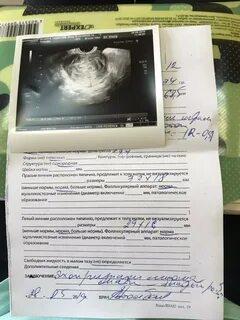 Пмс беременности на ранних сроках форум