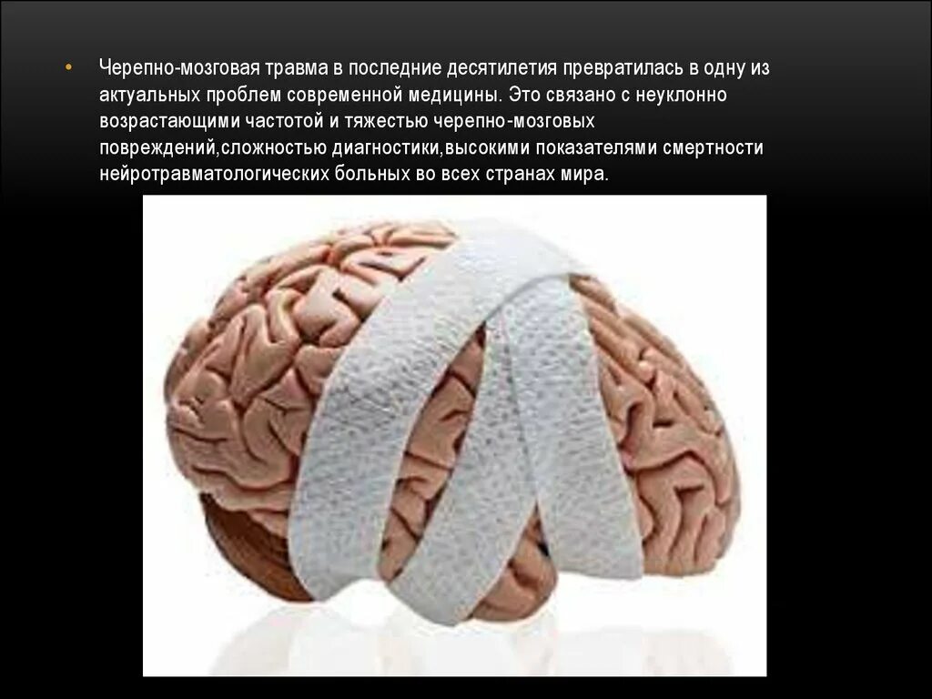 Мозгов получил травму. Черепно-мозговая травма. Черебномозговая травма. Повреждение головного мозга. Черепная мозговая травма.