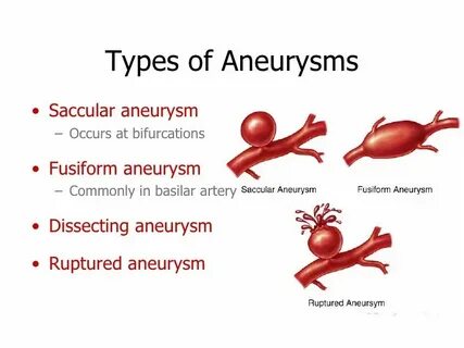 Aneurysm перевод