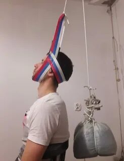 Вытяжение глиссона
