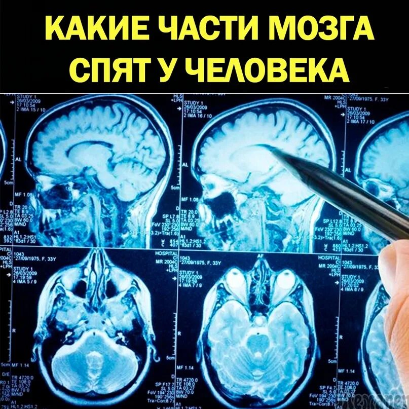 Поражение головного мозга неуточненное g93.9 что это. Необратимые нарушения головного мозга