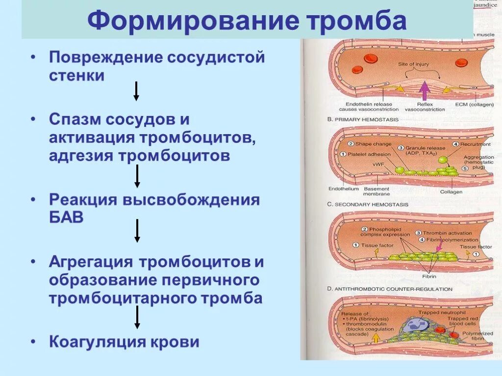 Стадии образования тромба при повреждении сосуда. Этапы образования тромба схема. Опишите процесс образования тромба.. Образование кровяного сгустка схема.