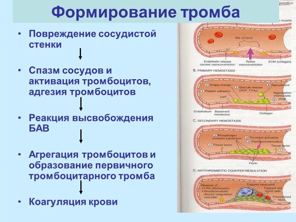 При повреждении сосудов тромбоциты. Стадии образования тромба при повреждении сосуда. Этапы образования тромба схема. Опишите процесс образования тромба.. Образование кровяного сгустка схема.