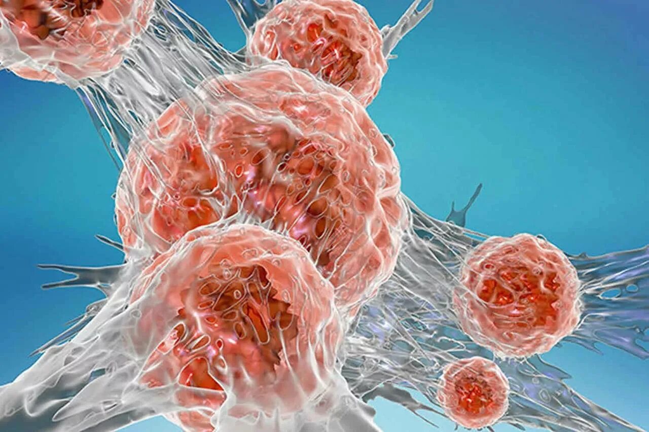 факторы развития онкологии. развитие онкологических заболеваний. опухолевые клетки. факторы риска развития онкологических заболеваний. молекулярная иммунология.