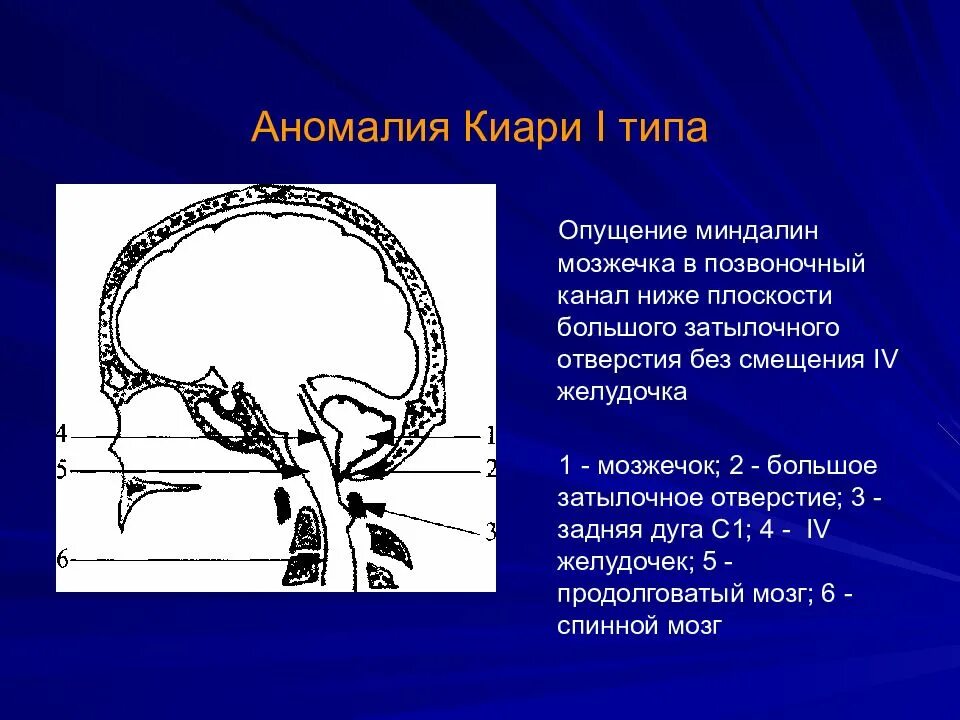 Мозжечок выше затылочного отверстия