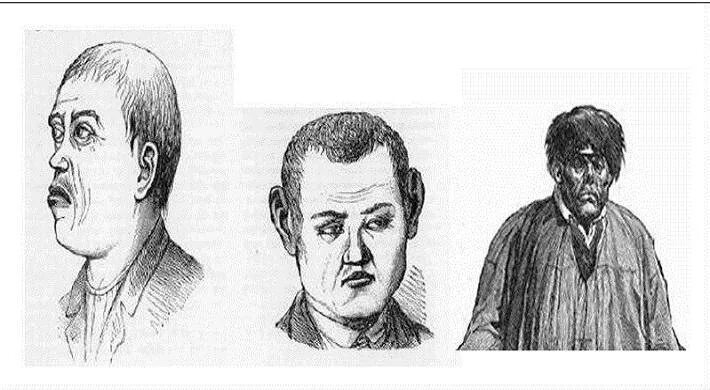 Чезаре ломброзо теория. Портрет преступника криминология ломброзо. Чезаре ломброзо прирожденного преступника. Чезаре ломброзо типы преступников. Чезаре ломброзо прирожденного преступника.