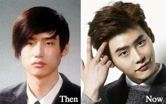 Ли чон сок до и после пластики. Lee jong suk before. ли чон сон до пластики. ли чон сок до операции. ли чон сок до пластики.