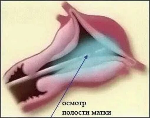 Маленькие малые губы