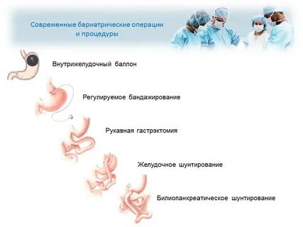 Бариатрическая операция что это