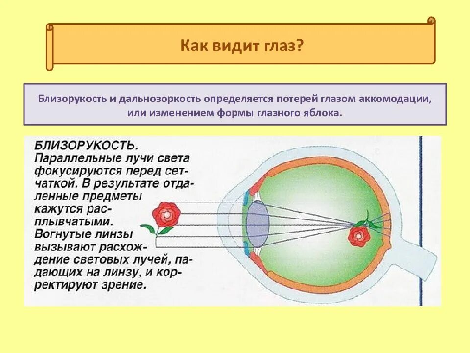 Дальнозоркость форма глазного яблока. Как видит глаз. Строение глаза дальнозоркость. Глаз дальнозоркость и близорукость. Как видят дальнозоркие люди