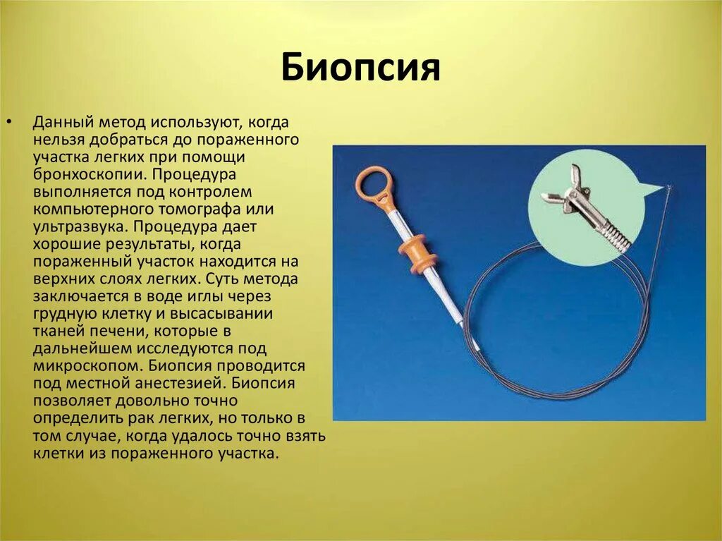 Биопсия легких как проводится. Пункционная биопсия легких. Бронхоскопия и биопсия легких. Биопсия легкого при бронхоскопии.