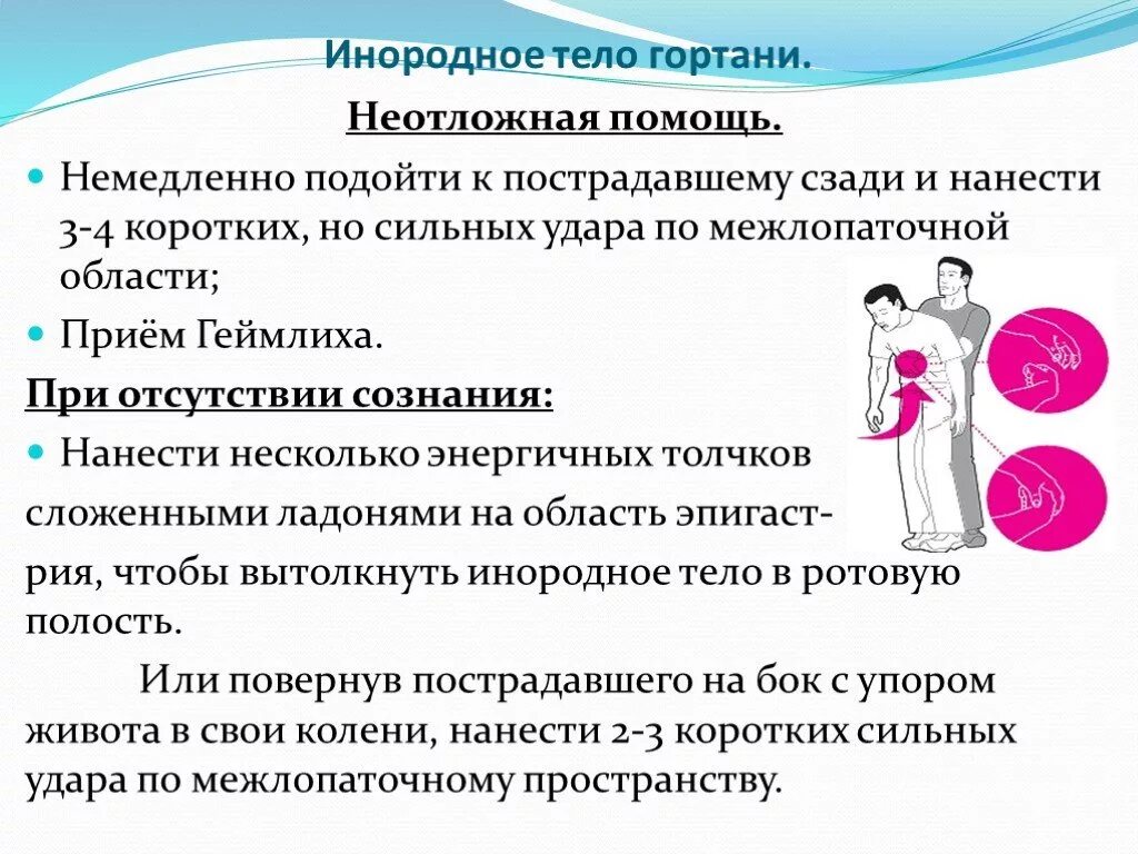 Первая помощь при попадании в глотку. Неотложная помощь при попадании инородного тела в гортань. Неотложная помощь при попадании инородного тела в гортань, в трахею. Неотложная помощь при инородном теле глотки. Неотложная помощь при инородном теле гортани.