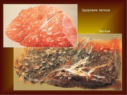 Легкие стали