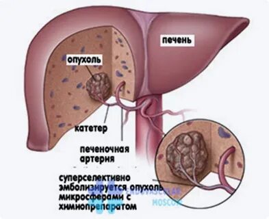 Печень побочные эффекты