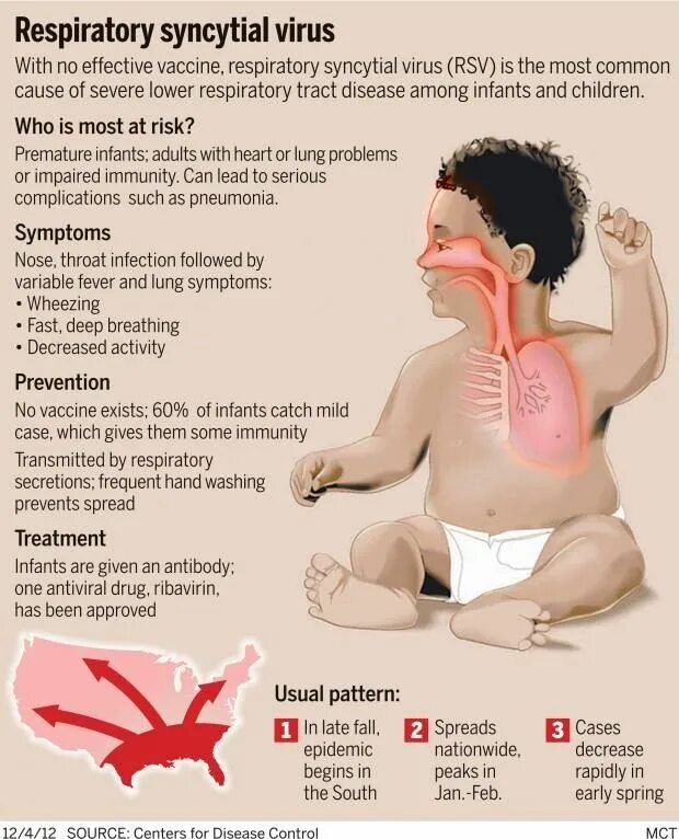 РСВ вирус. Respiratory syncytial virus Infectious disease. Respiratory syncytial virus. Syncytial virus