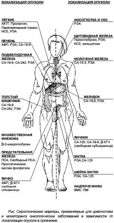 Онкологические маркеры. Онкомаркеры по локализации опухоли. Опухолевые маркеры РЭА. Схема онкомаркеров. Онкомаркеры схема на человеке.