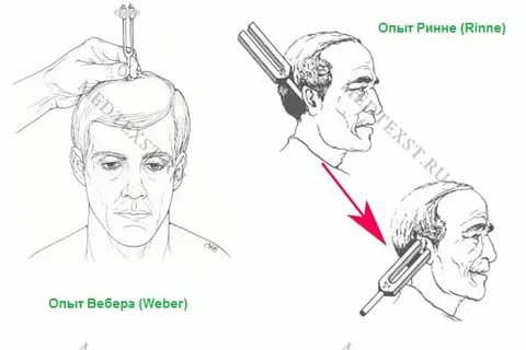Устройство вебера