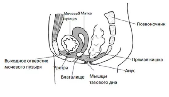 Лейомиома шейки матки мрт. Эмболизация маточных артерий. Пессарий на шейку матки при беременности. Матка давит на прямую кишку. Выпадение прямой кишки этиология.