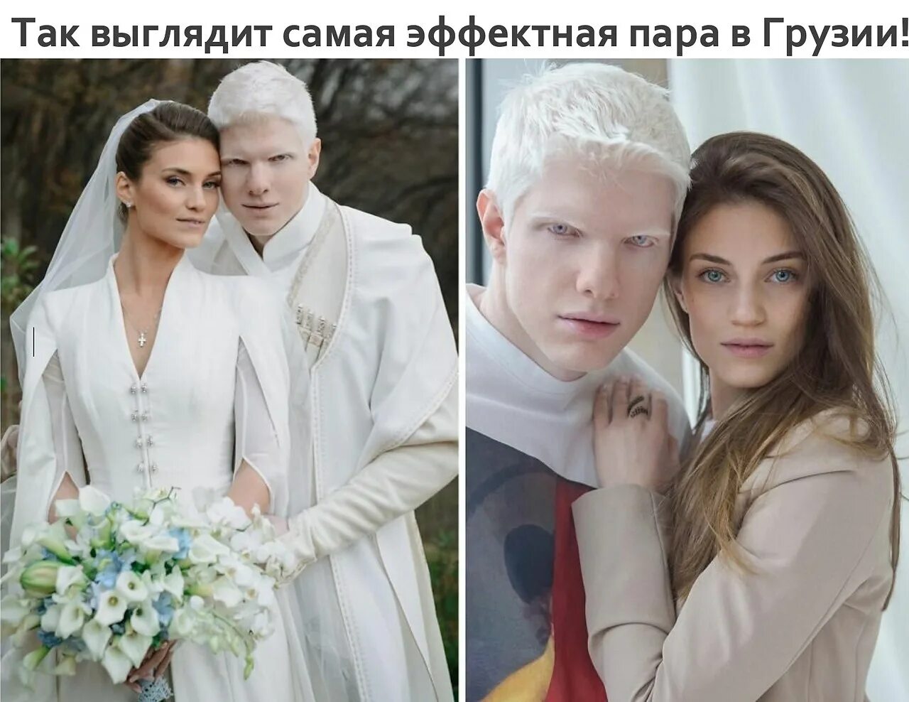 Альбинос модель и его жена. Бера иванишвили (bera). бера иванишвили свадьба. бера иванишвили альбинос. бера иванишвили - сын миллиардера - грузин-альбинос.