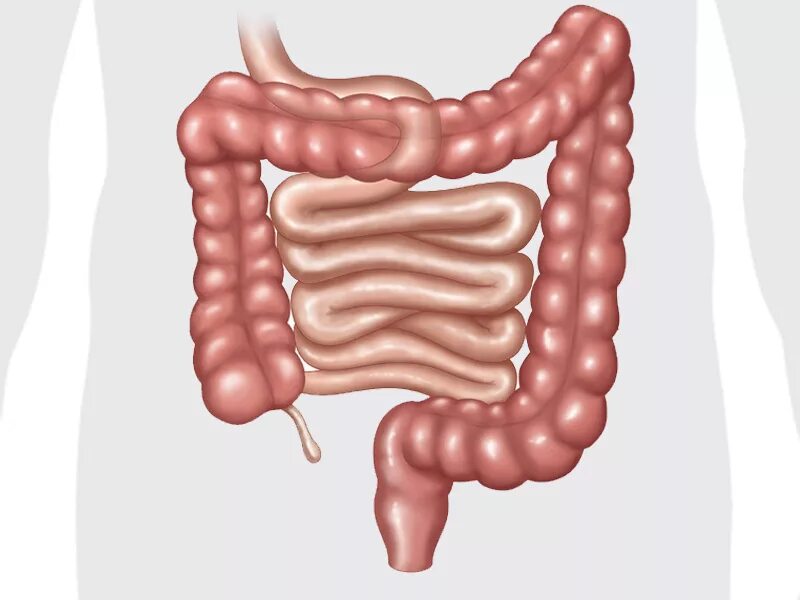 Энтероколит кишечника симптомы. Толстая кишка начинается