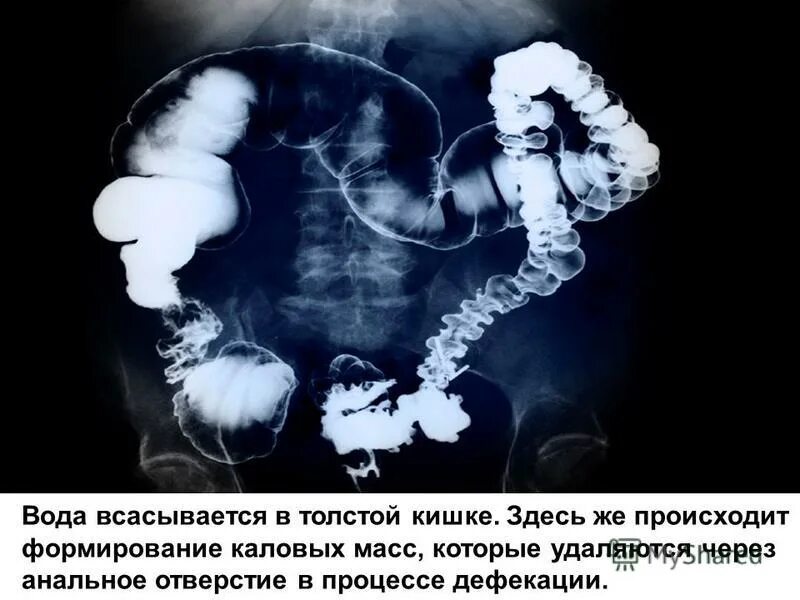 Формирование каловых масс. Формирование кала в кишечнике. Вода всасывается в толстом кишечнике. Где происходит формирование каловых. Отделы толстой кишки строение функции.
