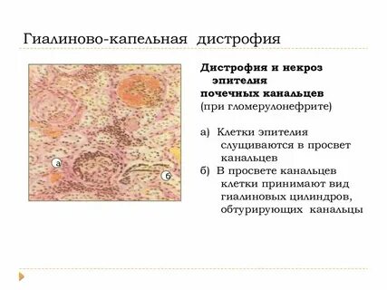 Просвет почечного канальца