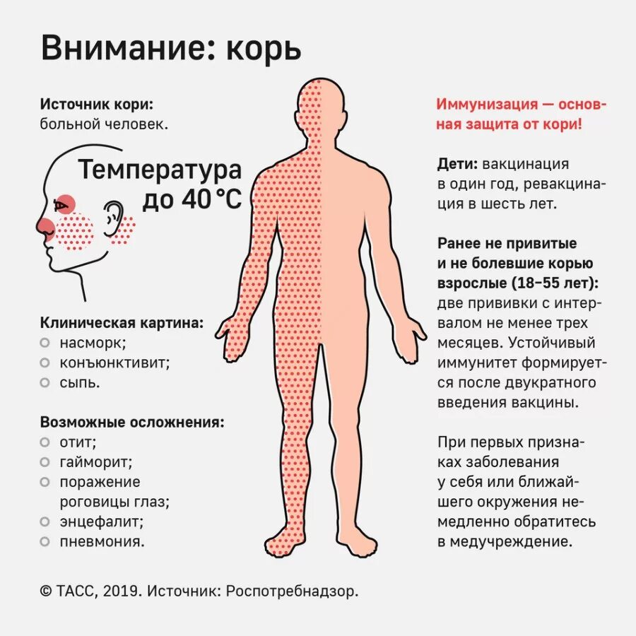 Корь, краснуха, паротит - 21 ответов форум Babyblog