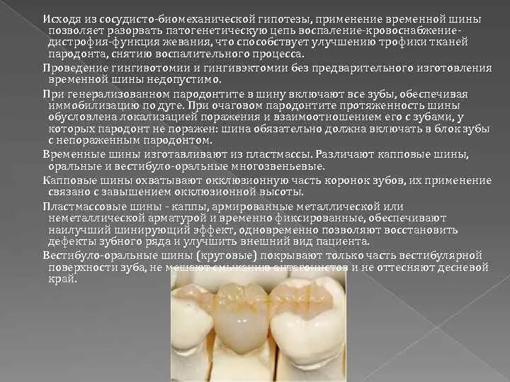 Классификация пародонта. Классификация пародонта