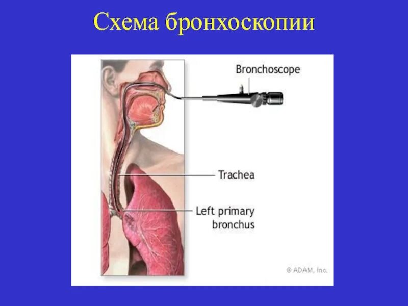 Как делается бронхоскопия легких видео. Бронхоскопия презентация. бронхоскопия схема бронхов.