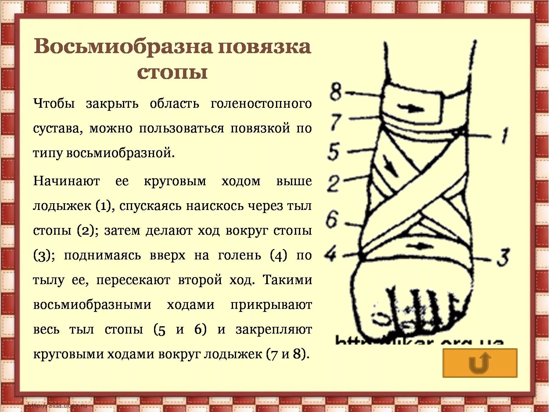 Восьмиобразная повязка на стопу алгоритм. Восьмиобразная повязка на голеностопный сустав алгоритм. Техника наложения восьмиобразной повязки на голеностопный сустав. Техника наложения восьмиобразной повязки. Какая повязка при повреждении голеностопного сустава