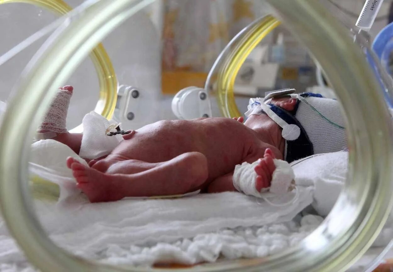 37 недели родившись дети. Выхаживание новорожденных. Недоношенный новорожденный. Выхаживание недоношенных детей.